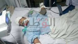 بسبب سلك كهرباء مكشوف علي الكورنيش زياد ابن بورسعيد في الغيبوبة في الاميرى منذ ثلاثة أيام