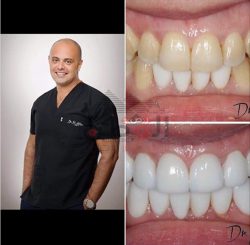 بالصور…دكتور محمد العالم ” الليزر المائي يزيل تصبغات اللثة والأسنان فى ٣٠ دقيقة بدون ألم